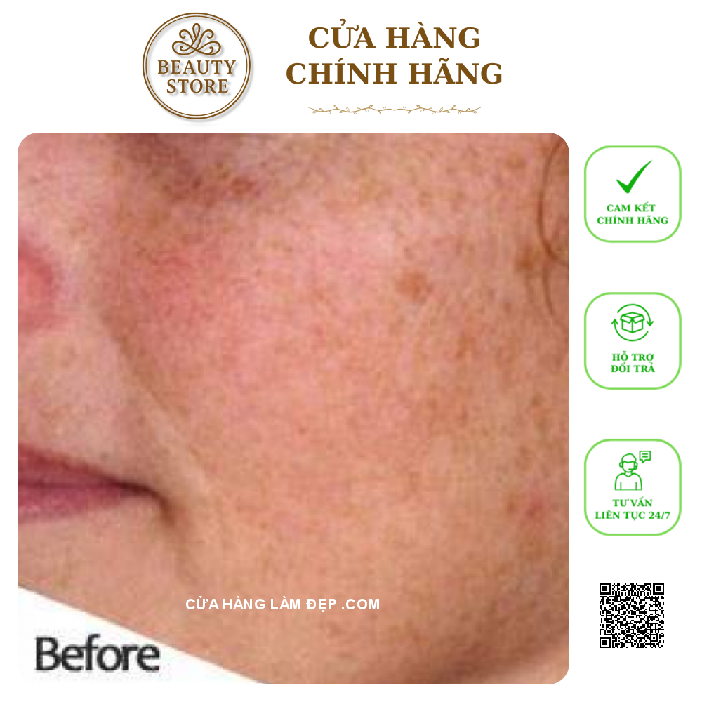 KEM TRỊ NÁM TRẮNG DA SAKURA WHITENING NIGHT CREAM