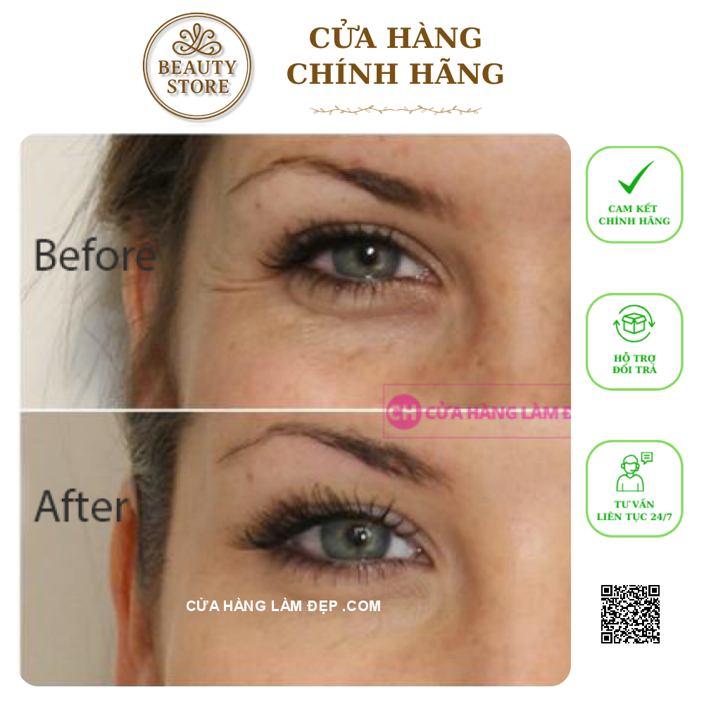 Kem Mờ Thâm Quầng Mắt, Bọng Mắt Sampar Splendid Eyes Elation