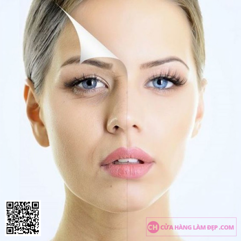 Nâng Cơ - Xóa Nhăn Da Mặt Công Nghệ tại Meli Spa