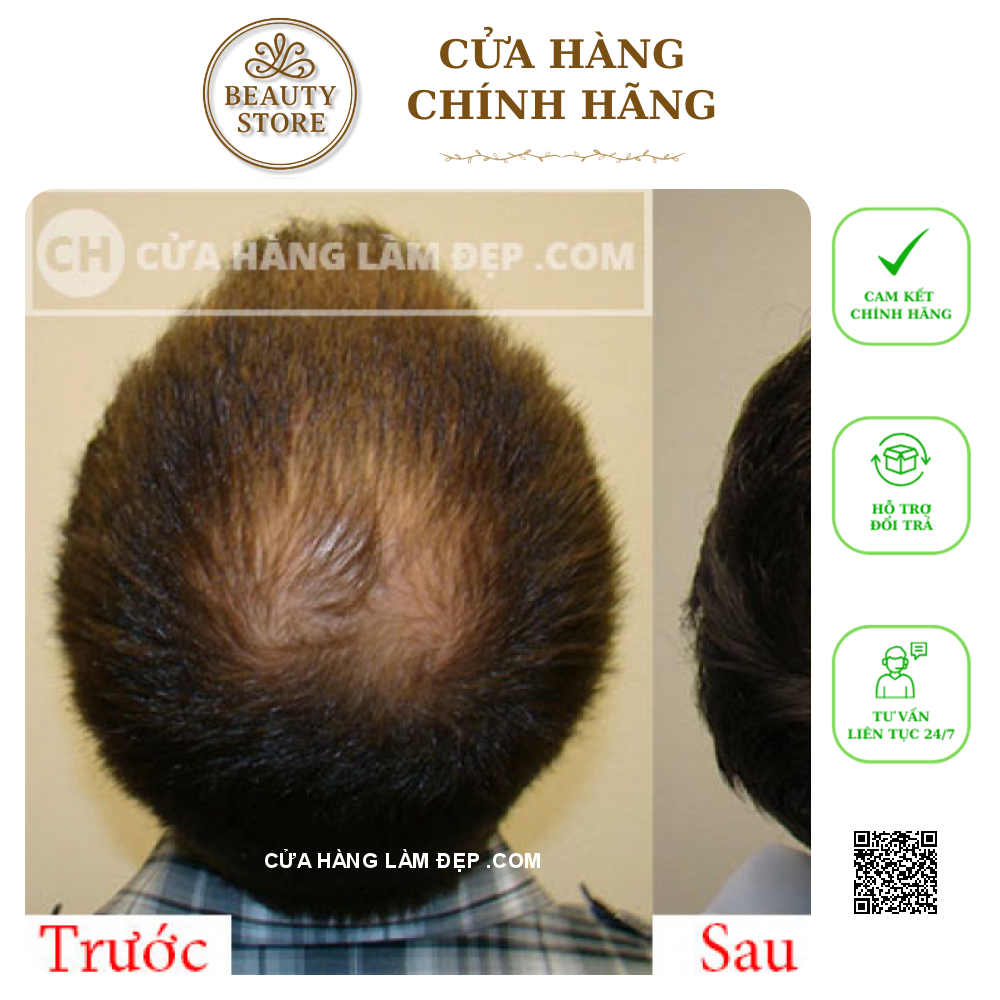 Tinh Chất Kích Thích Mọc Tóc Thảo Dược AROVICS Nhật Bản