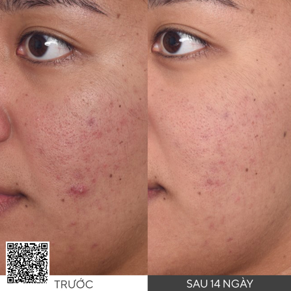 Murad Rapid Dark Spot Correcting Serum Tinh Chất Làm Mờ Vết Nám Và Giảm Sự Hình Thành Đốm Nâu 30ml Từ Hoa Kỳ