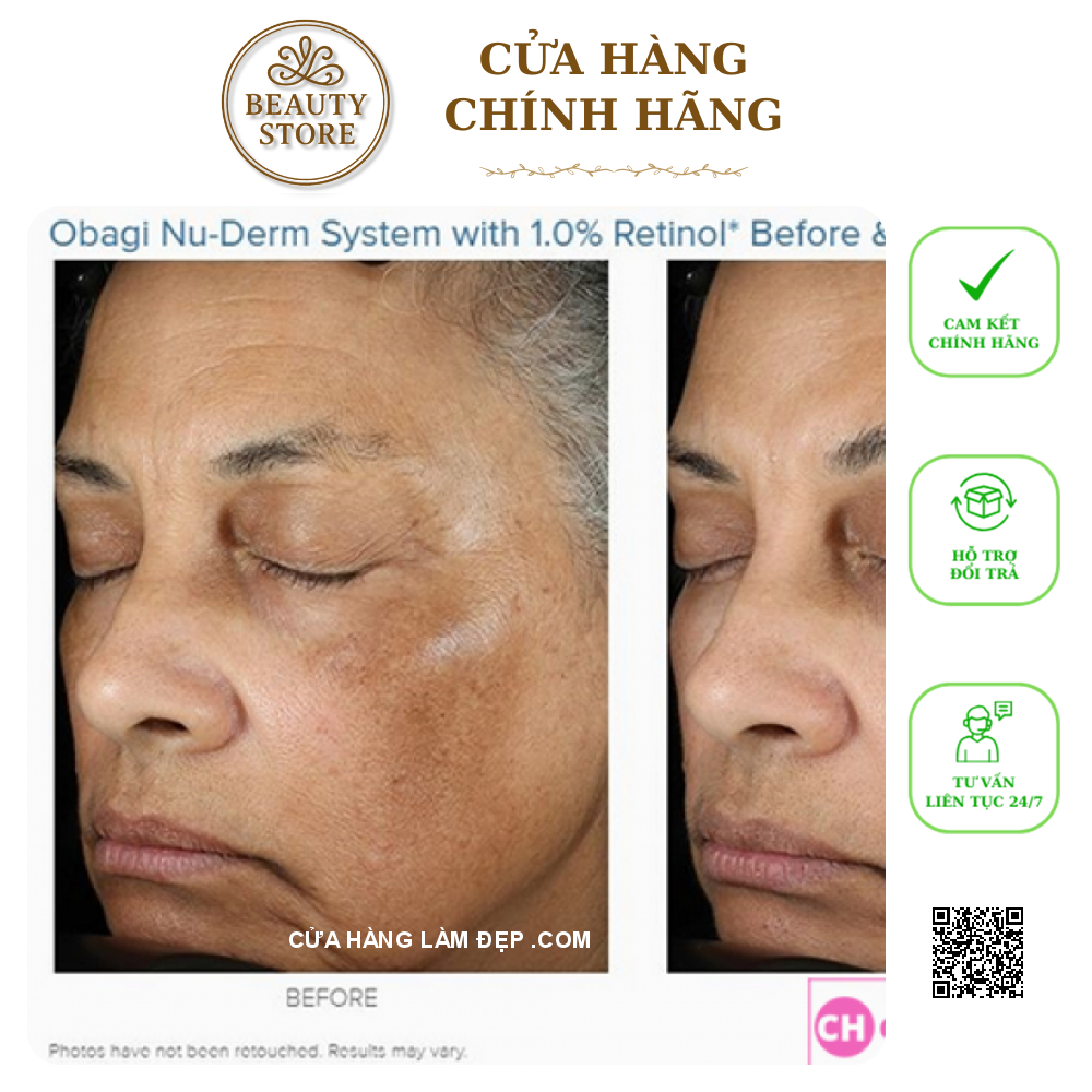 Kem dưỡng da hỗ trợ trẻ hóa, ngừa mụn, cân bằng sắc tố da Obagi 360 Retinol 1.0%