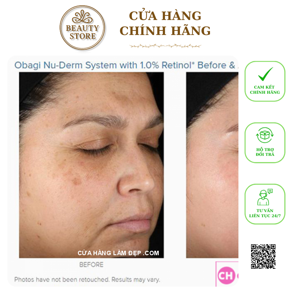 Kem dưỡng da hỗ trợ trẻ hóa, ngừa mụn,cân bằng sắc tố da Obagi 360 Retinol 0.5%