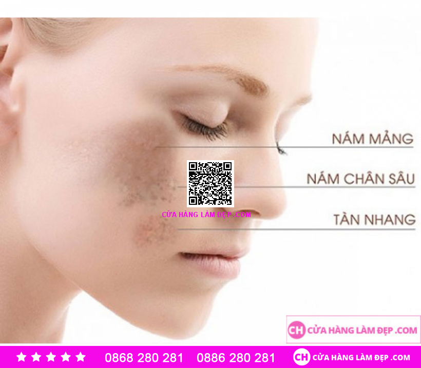 Enzyme Mờ Nám Dưỡng Trắng Da Sakura Active Brightening Complex