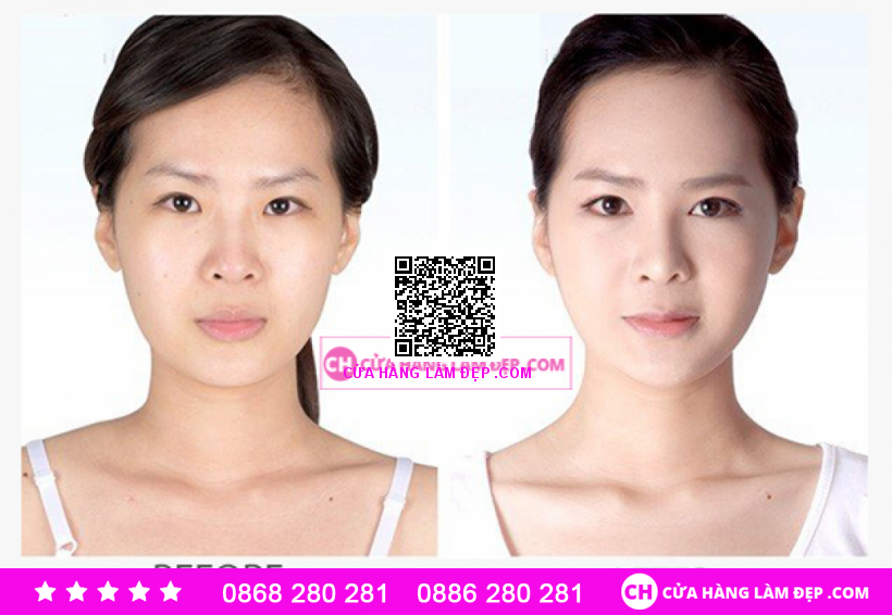Kem Dưỡng Ẩm, Hỗ Trợ Ngừa Lão Hóa Obagi Gentle Rejuvenation Skin Calming Cream