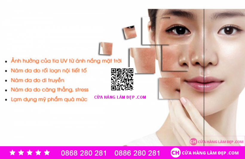 Kem Mờ Nám, Trắng Da An Toàn Wcare With Nano