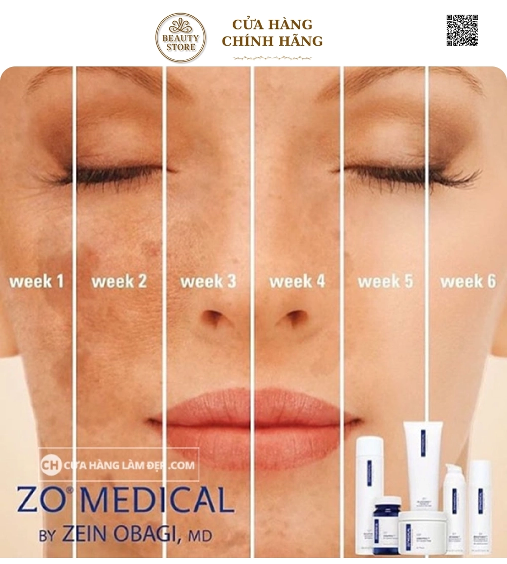 Kem Dưỡng Sáng, Tái Tạo Da ZO Brightenex Skin Britener and Correcting Cream