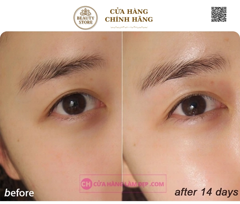 Viên Uống Cấp Nước Collagen Hàn Quốc Innerb Aqua Rich 70 Viên