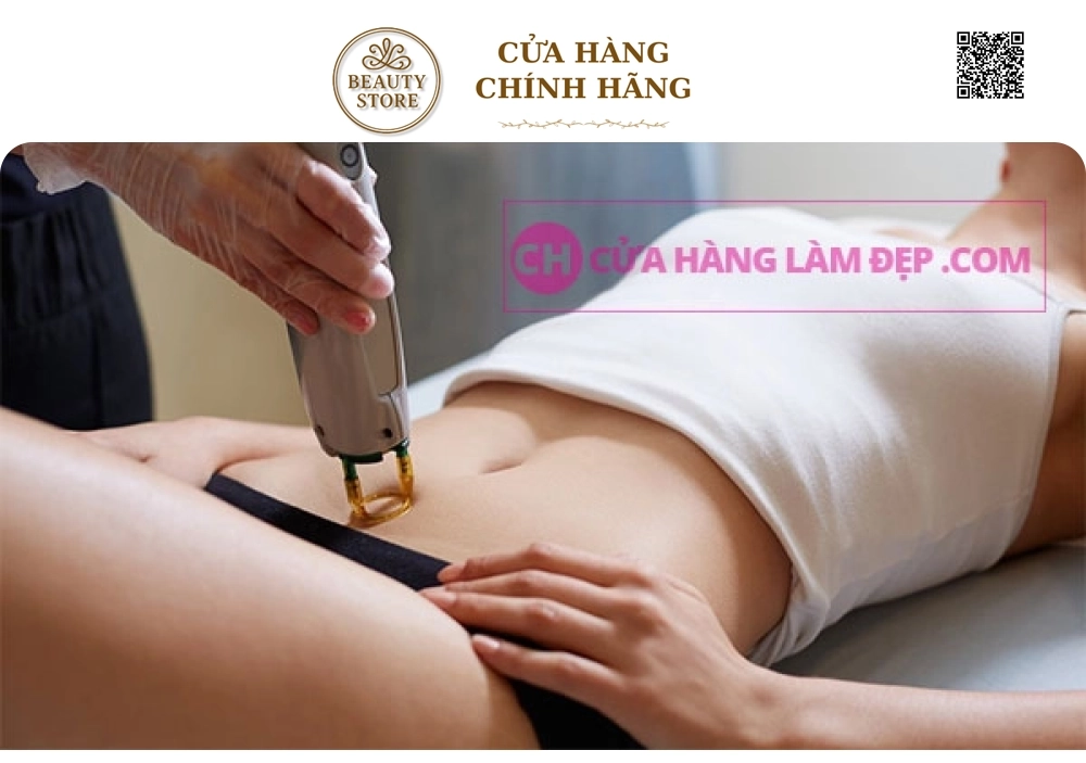 Triệt Lông Bikini Tại MeliSpa