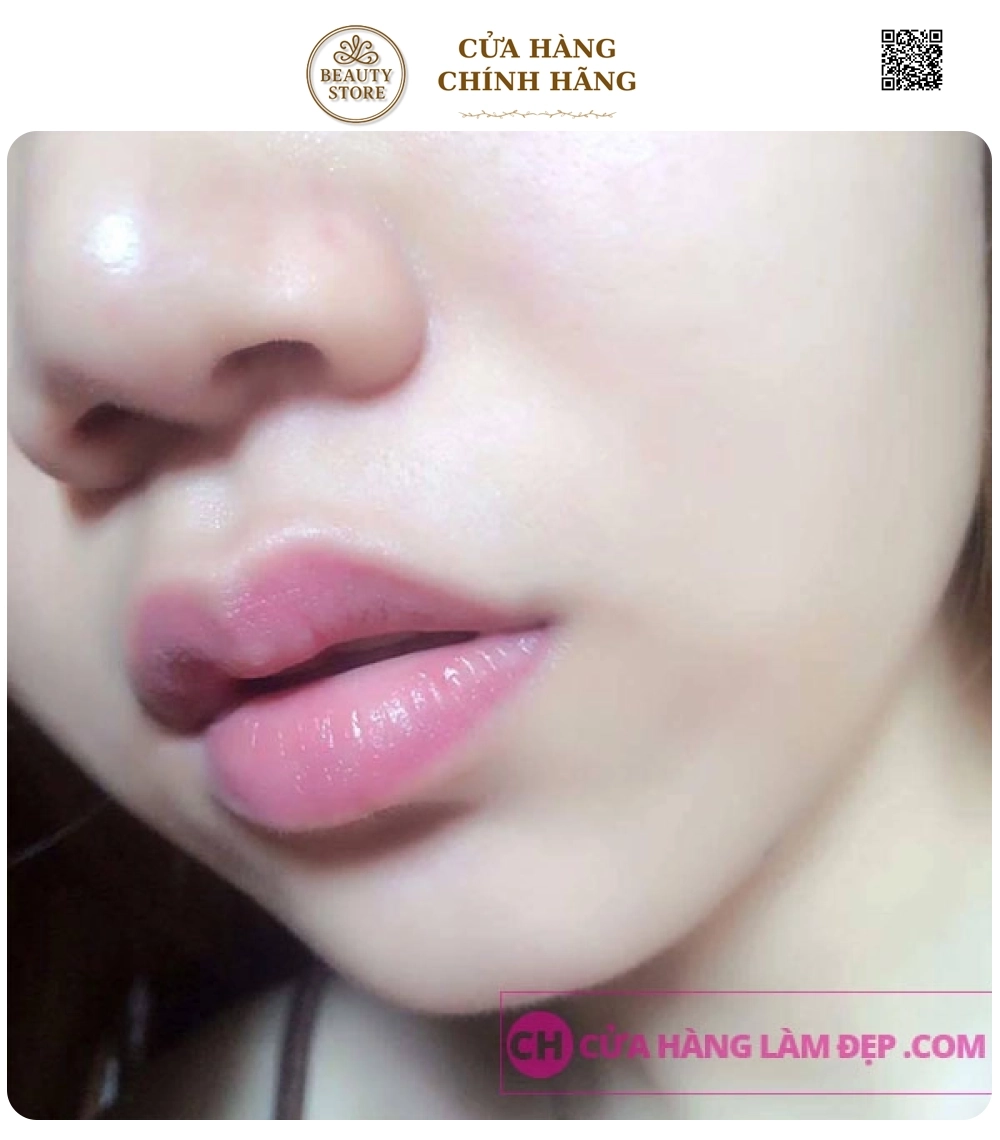 Phun Môi Tinh Chất Tế Bào Tại MeliSpa