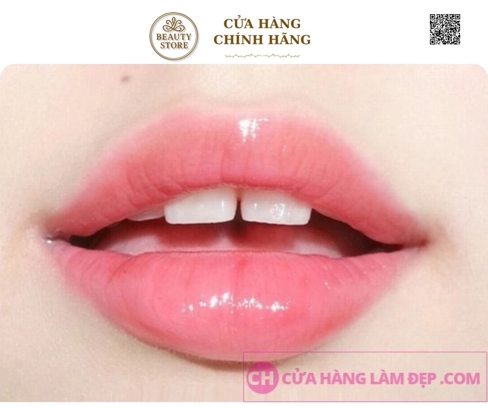 Phun Môi Pha Lê, Căng Bóng Công Nghệ Châu Âu tại Meli Spa