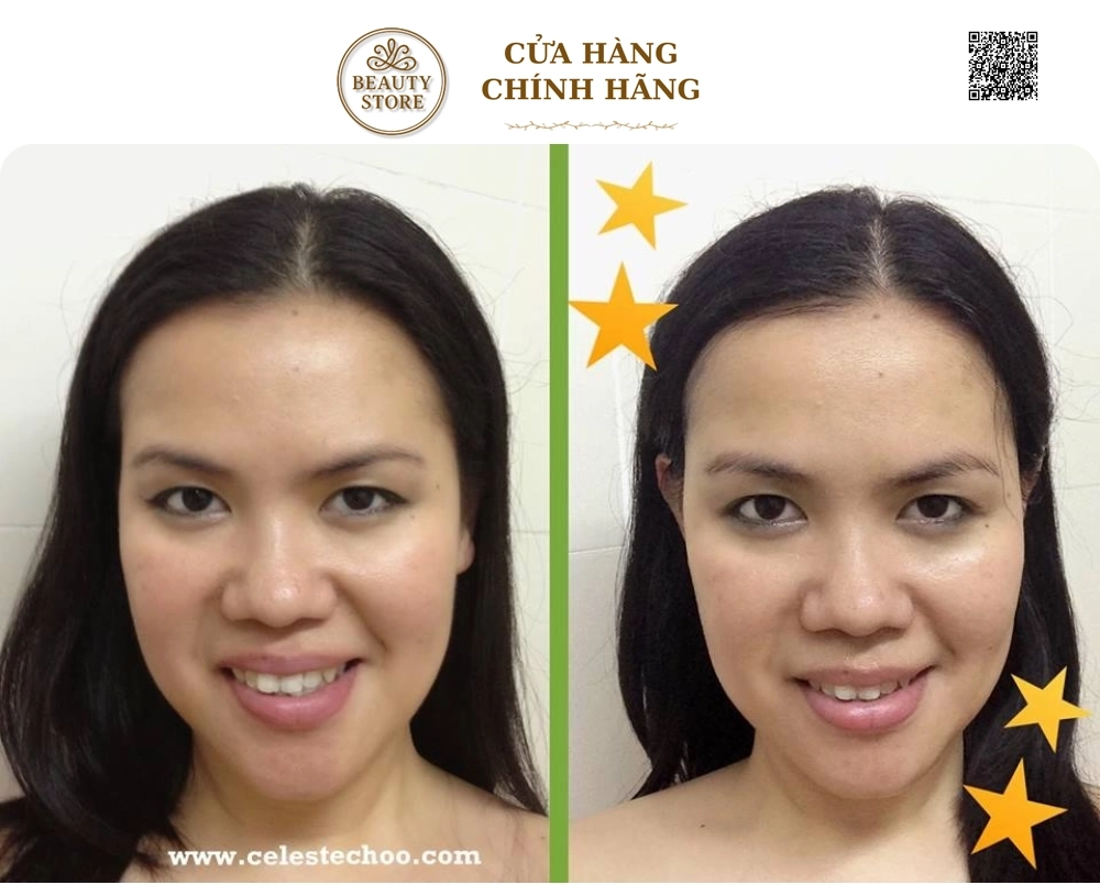Sữa Rửa Mặt Giảm Mụn Cám, Mụn Đầu Đen Neutrogena Blackhead Eliminating Daily Scrub của Mỹ
