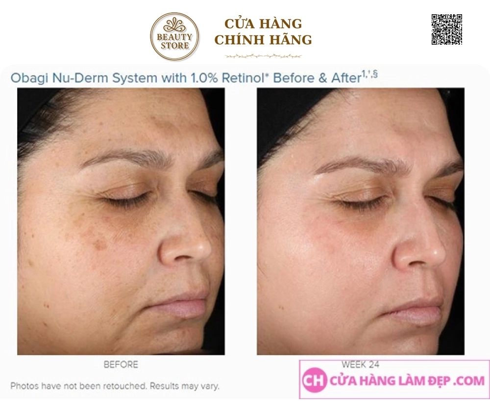 Kem dưỡng da trẻ hóa, ngừa mụn,cân bằng sắc tố da Obagi 360 Retinol 0.5%