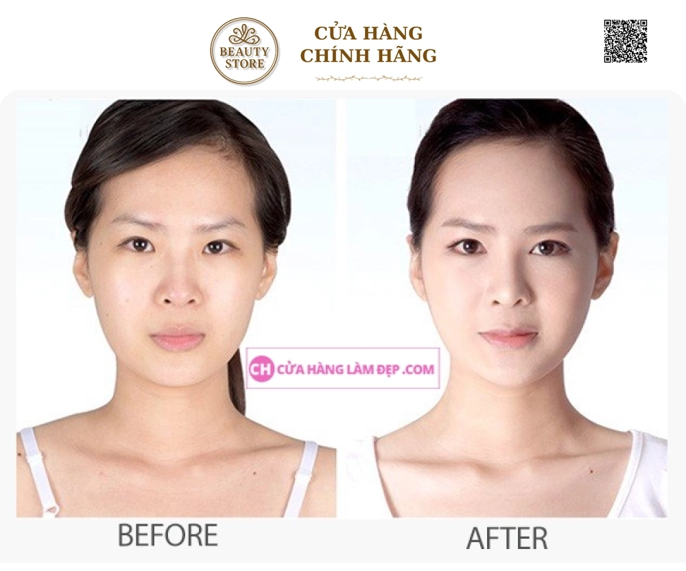 Kem Dưỡng Ẩm, Hỗ Trợ Ngừa Lão Hóa Obagi Gentle Rejuvenation Skin Calming Cream
